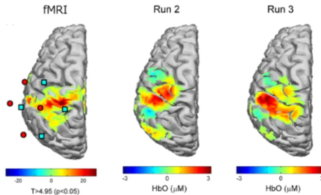 Fig. 15  fMRI and DOT measurement repeatability  21) . 