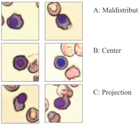 Fig.  2 .   The candidate erythroblasts automatically selected (green  frame) and a technician sorted out the morphological  erythroblasts from the candidate cells.