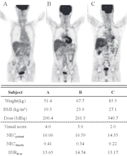 Fig. 1  Normal FDG-PET images of three subjects (A–C) evalu- evalu-ated by visual score, NEC patient , NEC density  and SNR liver .