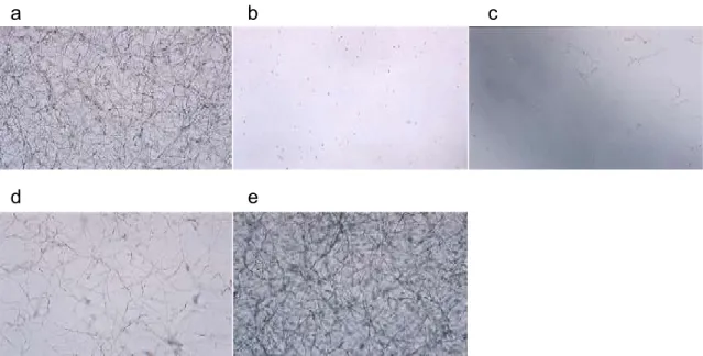 図 1-2 血清添加培地における A.  fumigatus の菌糸発育とイトラコナゾールの MIC 判定基準 