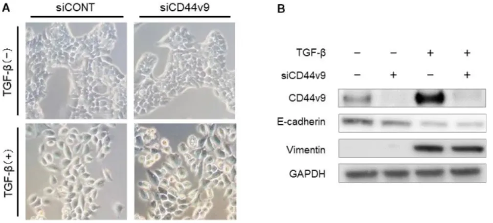 FIGURE 5  Migration and invasiveness of ESCC cells transfected with siCD44v9. Representative (A) migration and (B) invasion assays