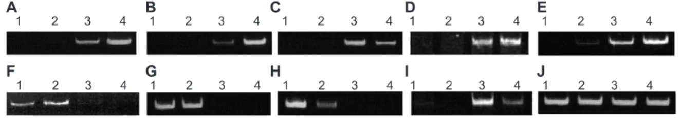 Fig. 1. Representative RT-PCR analysis of Hox genes. Total RNA isolated from MIN6 (lane 1), hTC1 (lane 2), aTC1.6 (lane 3), and GLUTag (lane 4) was reverse-transcribed and PCR was performed with specific primers