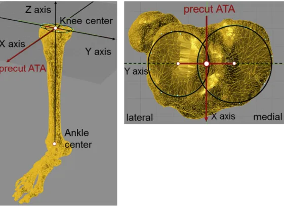 Fig. 3. Cutting the proximal tibial bone with 3 different posterior tibial slopes. The cutting direction of the tibia was along the precut ATA in the XY plane with 3 different posterior tibial slopes (0  , 3  , and 7  relative to the tibial mechanical axis