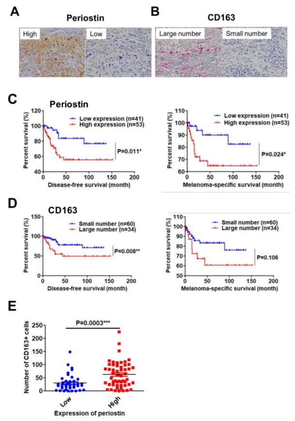Figure 4. High periostin expression and a large number of infiltrated M2 macrophages are significantly correlated with poor prognosis in patients with melanoma