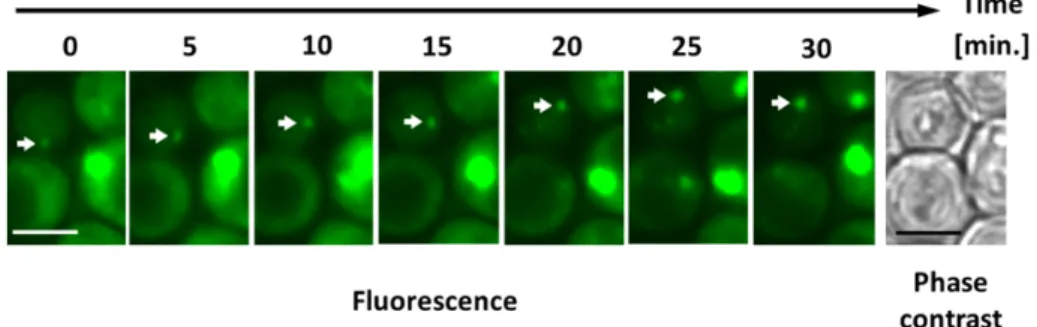 Fig. 4 Time-dependent localization change of the eno(1–28) fragment fused to EGFP   Scale  bar: 5 m
