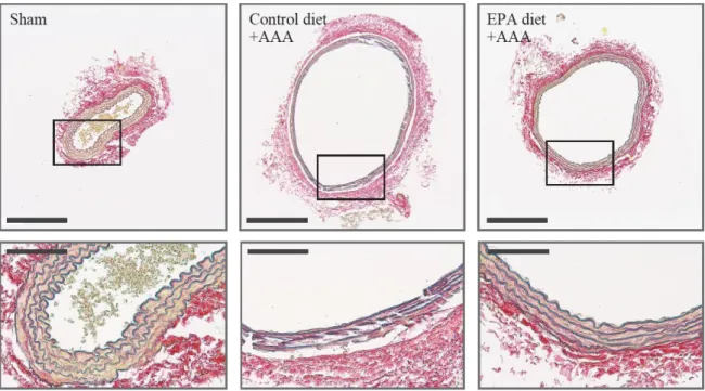 Figure  4.  Administration  of  EPA  preserves  vascular  wall  structure  in  AAAs. 