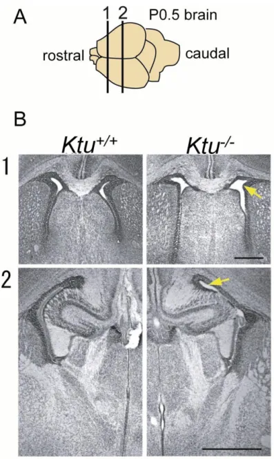Fig. 7. Hydrocephalus initiates between E18-P0 