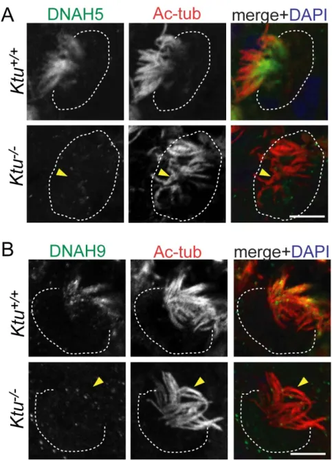Fig. 8. Absence of axonemal dynein components in the Ktu -/-  in brain ependyma  (A) Ciliary localization of axonemal dynein was visualized by immunofluorescence of  ependymal cells in P7  lateral ventricles with anti-DNAH5 pAb and anti-acetylated  α-tubul