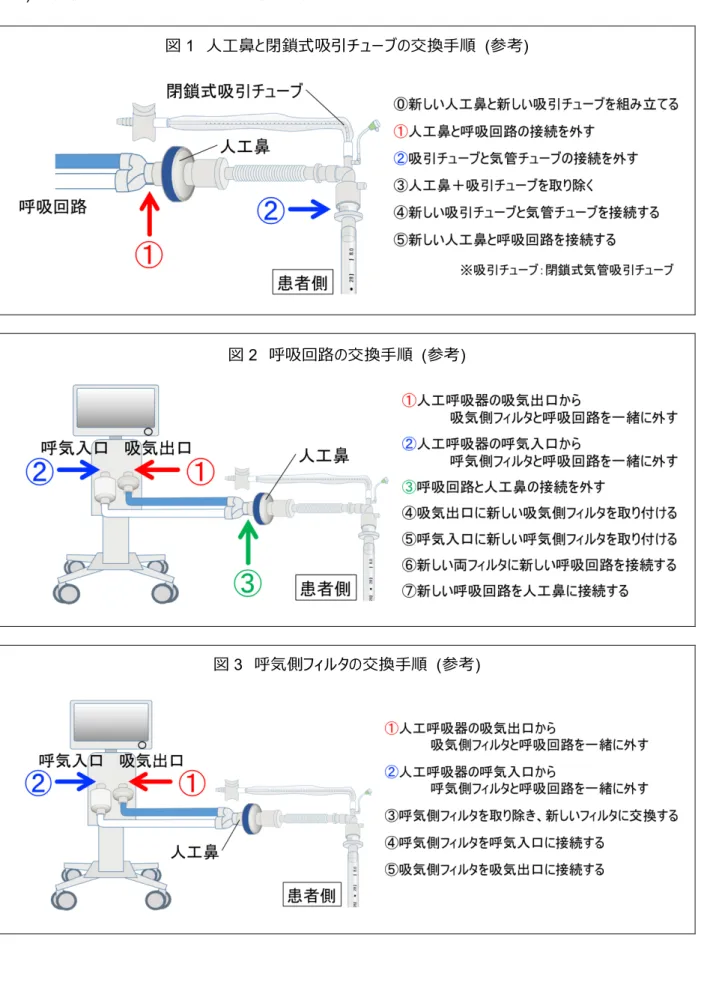 図 1  ⼈⼯⿐と閉鎖式吸引チューブの交換⼿順  (参考) 