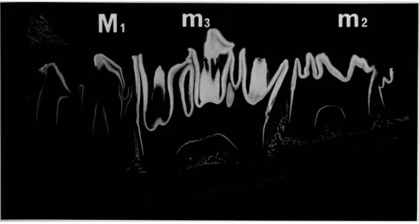 Fig.  2  7  months  in  utero.  Microradiogram  of  mesiodistal  ground  section  of  mandibular