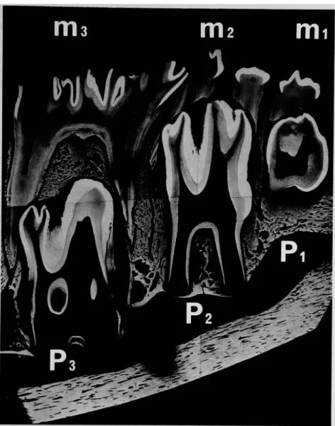 Fig.  6  1.5  years  after  birth.  Microradiogram  of  mesiodistal  ground  section  of          the  lower  permanent  premolars  and  their  surrounding  alveolar   bone(  x2) .