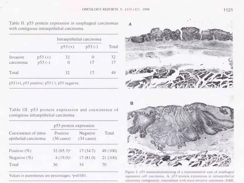 Table  III .   p53  protein  expression  and  coexistence  of  contiguous  intraepithelial  carcinoma