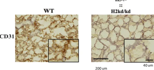 Figure  11.  Immunohistochemistry  analysis  performed  to  sections  from  the  neonatal WT and double-mutant mice at two to three days of age by staining with  the  CD31  antibody