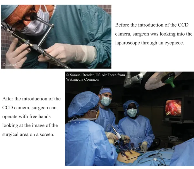 Figure 1.2 Laparoscopy: before and after the introduction of CCD camera. 