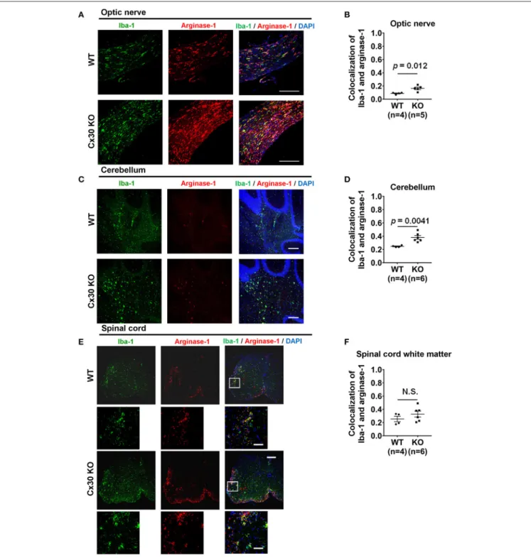 FIGURE 6 | Anti-inflammatory marker expression of microglia in WT and Cx30 KO mice with chronic EAE
