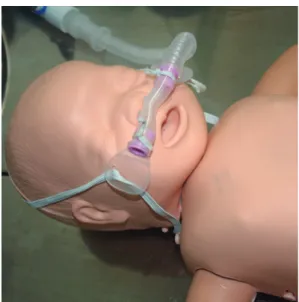 Figure 1. Nasal cannula for this patient. Foxxmed nasal cannula is fixed by an elastic band instead of the original headcap