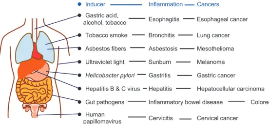 Figure 1 Inflammation  as  an  important  risk  factor  in  development  of  cancer  (Modified  from reference 3).
