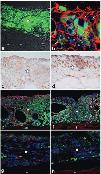 Figure 10 Involvement  of  bone  marrow-derived  intraperitoneal  cells  in  FIA-induced  lymphangiomas.