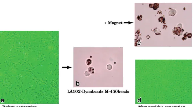 Figure 4 Positive separation of lymphatic endothelial cells from adjuvant-induced lymph- Figure 4 Positive separation of lymphatic endothelial cells from adjuvant-induced lymph-angiomas by MACS using magnetic beads conjugated with LA102