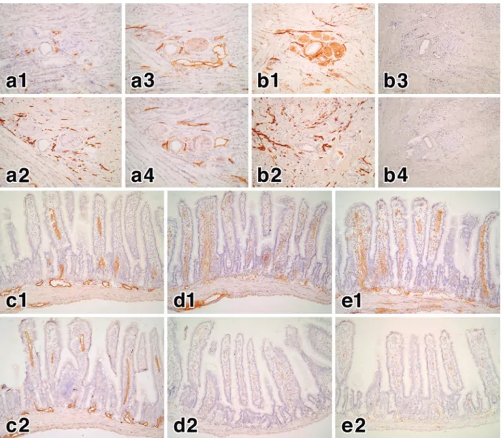 Figure 5 Effects  of  Thy-1  background  and  phospholipase  C  treatment  on  the  antigens  recognized by LA102 and other antibodies.