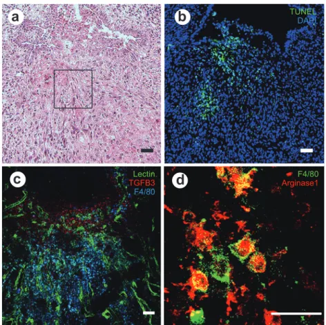 Figure 4 Microscopic changes in the uterine tissue on postpartum day 3.   (a) Hematoxylin and eosin staining. (b) TUNEL (green) and Dapi (blue) staining. (c) Immuno- histochemical staining for lectin (green), TGFB3 (red), and F4/80 (blue). (d)  Enlarged he