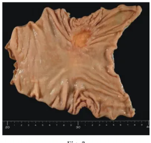 Fig. 2 FDG-PET