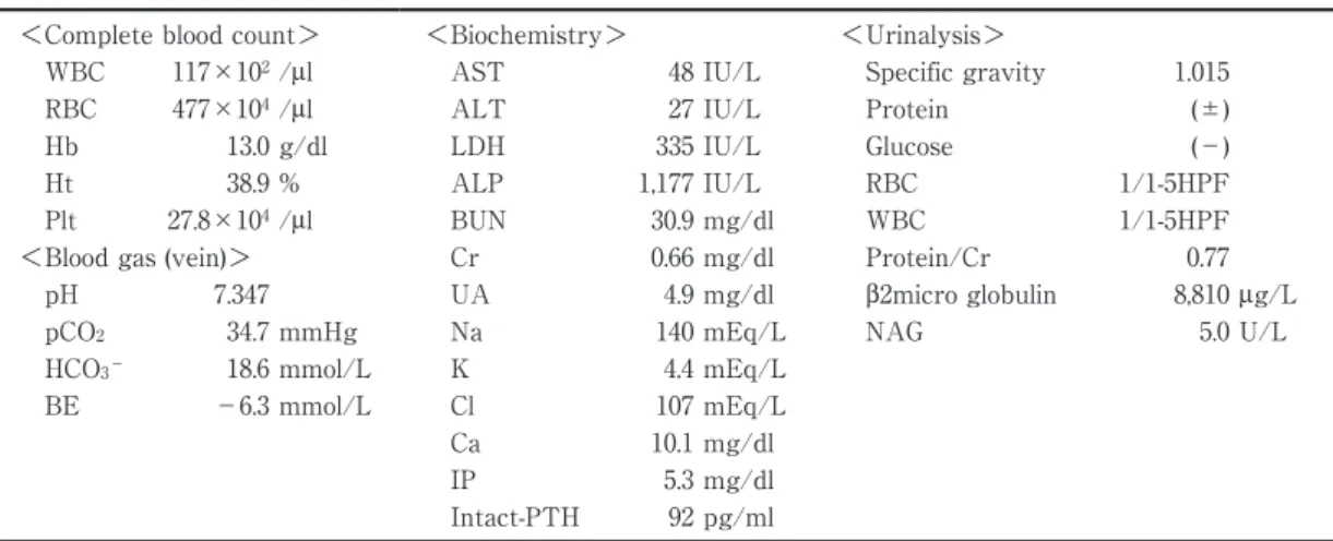 Fig. 2 Sequencing of exon3 of the PAX2 gene One  heterozygous  mutation  in  exon  3  was  observed. 