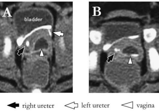 Fig. 4 Enhanced computed tomography scan