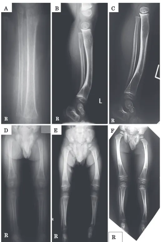 Fig. 3 X-ray of lower extremities