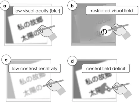 Figure 1. Different aspects of Visual deterioration.