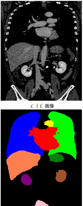 図 4.6: あるスライスに対するセグメンテーション結果の比較。