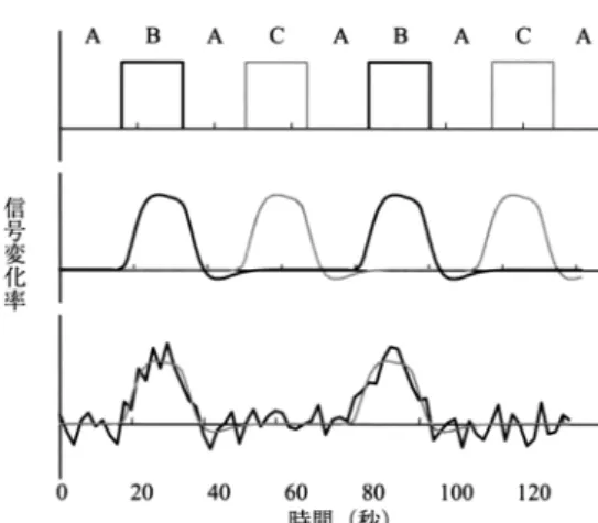 Figure 6. Flow of fMRI data processing using SPM  （block design） .