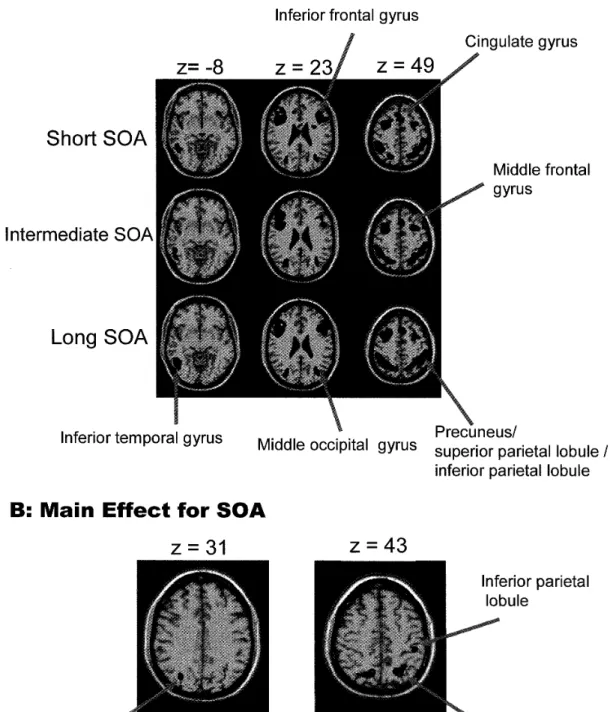 Figure 　 3 ． 　A ： Significant 　 activations 　 under 　 the 　 short ， 　 intermediate ， 　 and 　 long 　 SOA 　 corld ［ tions 　 at 　 the 　threshold 　 of 　 p 〈 ． 05 （ corrected ） with 　 an 　 extended 　 threshold 　 of 　 150 　 voxeLs ．　 B ： S 工 gnificant 　 activati