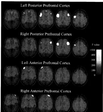 Figure 　5 ． 　Functional 　 connectivity 　 showing 　 regional 　 interactions　 in 　 the 　 PFC 　 network ，