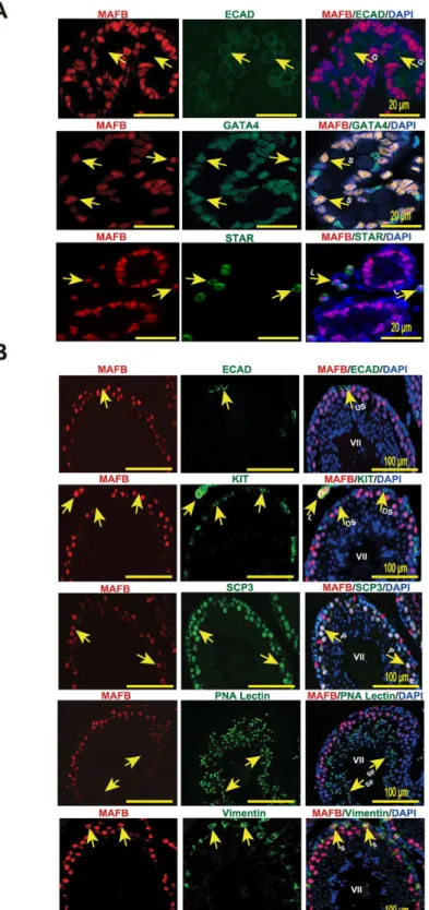 Fig 2. Localization of MAFB in mouse testes. (A) Localization of MAFB in E18.5 mouse testes