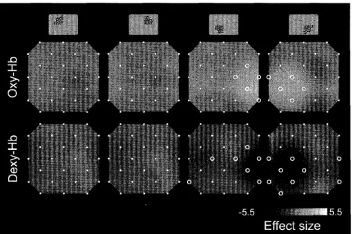 Figure 3. Topographjc rnaps for the Hb changes obtained with stimulation of each visual quadrant.