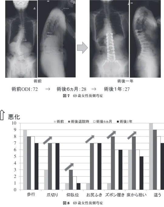 図 8 69 歳女性後側弯症