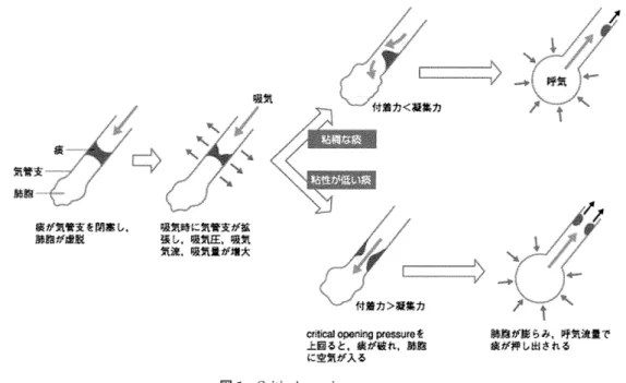 図 1Critical 　 opening 　 Pressure