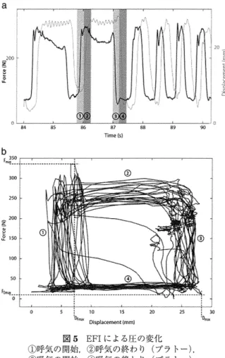 図 4Expiratory 　 fiow 　 increase 　 technique 　 　 EFI ： 呼 気 流量 増 加 手技 at2 藤蒼；ど£ tS ，t 略 br 轟艶 ‡ ＿． ： 　 　 f 瓶 遜 　 　 t 一 副 善 i 熱 麟 　 　 … 　 ； be 　 F 　 　 l 　 s ° 　 r 聴 ＿ 1． ＿ 　 o 　 鼻 ％ 　　　 　　 el 　　　 　　 5s　 　Timetsl 鈴 鱒 冫 c ．　tt ’し3誘四試興併 症 （呼 吸 窮 追の症 状，酸 素 飽和 度の低
