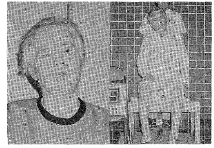 Fig. 1 At the time of hospitalization.