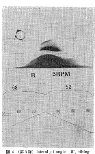 表 3Sulcus 　 angle と 最 大 筋 ［ 〃 ク と の 相 関 　 　 　 　 　 　 　 　 　 　 　 　 　 　 　 　 　 　 （n ＝33 ） 　 舮炉甲鼡　　“絆』訳〜ゴ壹　　氏　　　卓尋　5　　　　孝b　　3　　　　　　し　　自　　　日高耳島　　　　　　舞5穿臣，　　臣　蕁　砺日　p　　　きヒ∬7即韆卑¢巨　　 Fき獲頃灌蜜唱日　旬口　§蚕　」尚高 　　　　　　　　　　6　　ヒゴ　炉廴炉§　　わ　　　　　　　ジ　日r目　信　厂　σ　　　〜　　　　　　　　　　　　』　5　　⊆　　