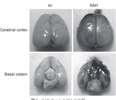 図 2 ．A：SAH 後の DNA 断片化．野生型ラットでは対照群と比較して SAH 後 24 時間に おける大脳皮質の DNA 断片化が有意に増加していた．SOD1Tg ラットでは SAH 後 24 時 間における DNA 断片化は野生型ラットと比較して有意に減少していた．B：SAH 後 24 時間における死亡率は SOD1Tg ラットにおいて有意に低かった．