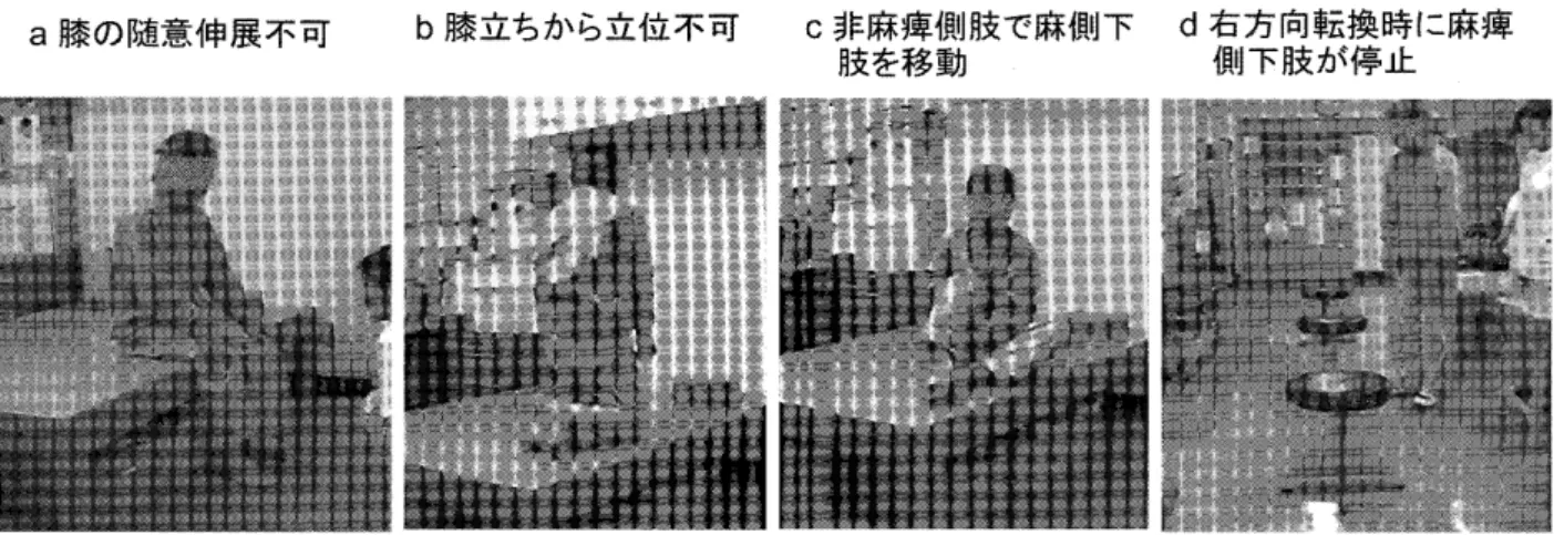 図 2 　 Modified 　 constraint 　 induced 　 m 〔 ｝ vement 　 iherapy 　 （ mCIT ） 介 入 前 の 基 本 動 作 と歩 行