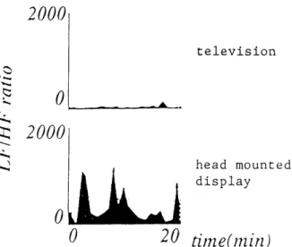 Fig． 4 　 LFIHF 　 ratio 　 of 　 HRV 　 with 　 TV ＆ HMD
