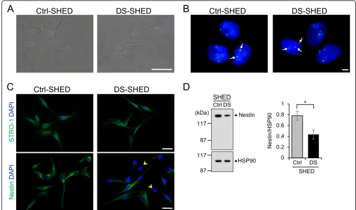 Fig. 1 Characterization of SHED isolated from a patient with DS. a The morphology of cells in the Ctrl- and DS-SHED was observed using phase-contrast microscopy