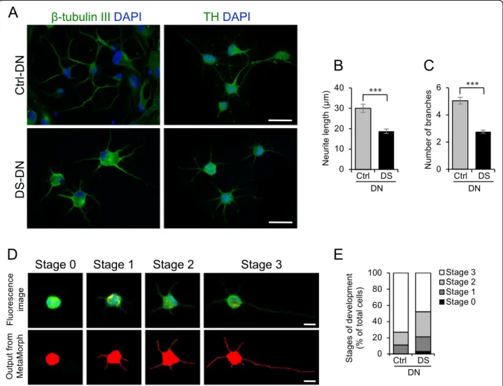 Fig. 2 DN differentiation of DS-SHED. a Ctrl- and DS-DN cells were observed by immunofluorescence microscopy using anti- β -tubulin III (left panel) and anti-TH (right panel) antibodies
