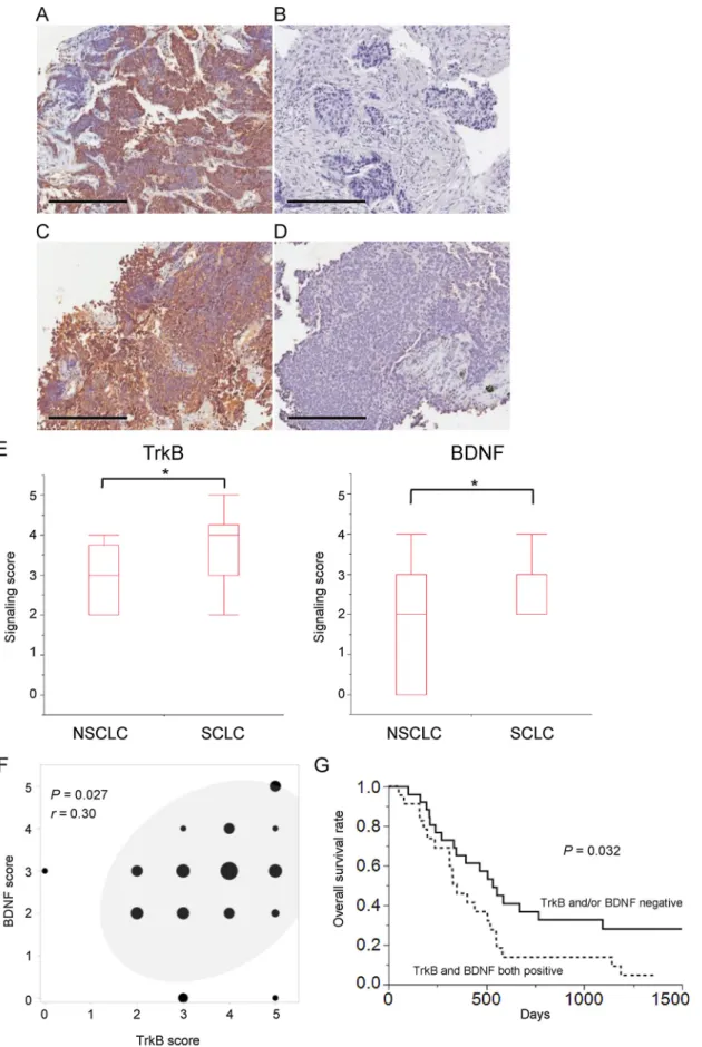 Fig. 1. Immunohistochemical analysis of TrkB and BDNF expression in SCLC specimens. (A – D) Representative positive (A, C) and negative (B, D) staining for TrkB (A, B) or BDNF (C, D) in tumor cells