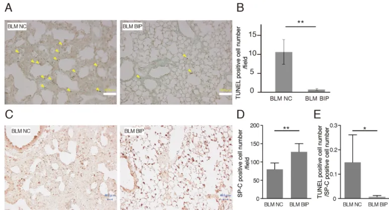 Fig. 4. BIP-V5 inhibits Bax activation in bleomycin-induced pneumopathy and bleomycin-treated A549 cells