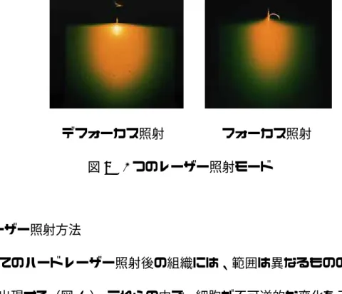 図 10   レーザーの持つ２つの作用