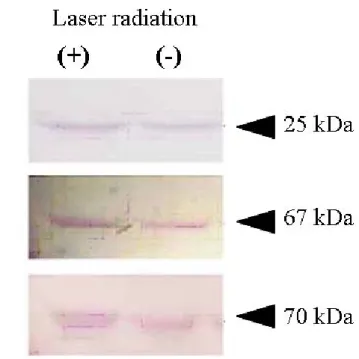 図 14  レーザー照射による歯に関連する蛋白質発現に対する影響  ③  レーザー照射の mRNA 発現に対する影響  歯胚細胞にレーザー照射したとき、歯に関連する mRNA 発現に対する影響を 調べた。レーザー照射 7 日後では、コントロール群に対する相対値に対して実 験群ではアメロジェニンおよびアメロブラスチンの mRNA 発現は高かった（図 15） 。一方、エナメリンおよびエナメライシン（MMP-20）mRNA の発現は、レ ーザー照射による影響を認めなかった。レーザー照射 7 日後の Runx2、Ｉ